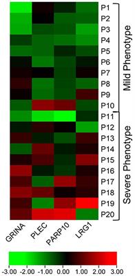 Expression of risk genes linked to vitamin D receptor super-enhancer regions and their association with phenotype severity in multiple sclerosis